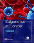 Image for Epigenetics in Cancer