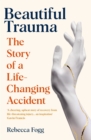 Image for Beautiful Trauma: A Journey of Discovery in Science and Healing