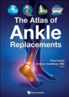 Image for Atlas Of Ankle Replacements, The