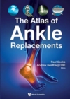 Image for The Atlas of Ankle Replacements