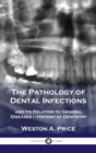 Image for Pathology of Dental Infections