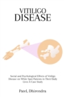 Image for Social and Psychological Effects of Vitiligo Disease on White Spot Patients in Their Daily Lives A Case Study