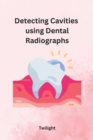 Image for Detecting Cavities using Dental Radiographs