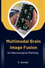 Image for Multimodal Brain Image Fusion for Neurosurgical Planning