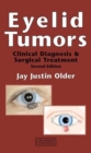 Image for Eyelid tumors  : clinical diagnosis and surgical treatment