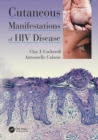 Image for Cutaneous manifestations of HIV disease