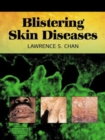 Image for Blistering skin diseases