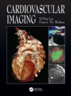 Image for Cardiovascular imaging