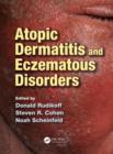 Image for Atopic dermatitis and eczematous disorders