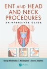 Image for ENT and Head and Neck Procedures