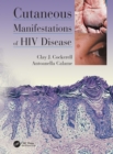 Image for Cutaneous manifestations of HIV disease
