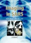 Image for Imaging in SARS
