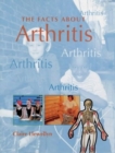Image for The facts about arthritis