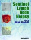 Image for Sentinel Lymph Node Biopsy
