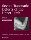 Image for Severe Tramatic Defects of the Upper Limb