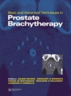 Image for Basic and Advanced Techniques in Prostate Brachytherapy