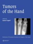 Image for Tumors of the Hand