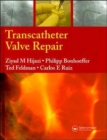 Image for Transcatheter Valve Repair
