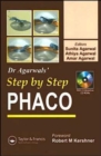 Image for Step by step phaco