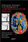 Image for Endovascular Techniques in the Management of Cerebrovascular Disease