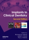 Image for Implants in clinical dentistry