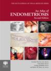 Image for An atlas of endometriosis