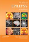 Image for An Atlas of Epilepsy