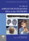 Image for An Atlas of Amplitude-integrated EEGs in the Newborn