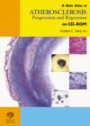 Image for A Slide Atlas of Atherosclerosis Progression and Regression on CD-Rom