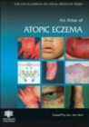 Image for An Atlas of Atopic Eczema