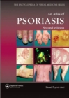 Image for An Atlas of Psoriasis, Second Edition