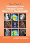 Image for Atlas and Manual of Cardiovascular Multidetector Computed Tomography
