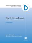 Image for 11-14 Week Scan Diag Fetal Abnorm