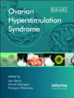Image for Ovarian Hyperstimulation Syndrome