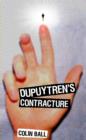 Image for Dupuytren&#39;s Contracture