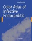 Image for Color atlas of infective endocarditis