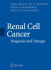 Image for Renal Cell Cancer