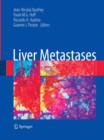 Image for Liver Metastases