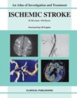 Image for Ischemic stroke  : an atlas of investigation and treatment