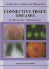 Image for Connective Tissue Diseases