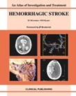 Image for Hemorrhagic stroke: an atlas of investigation and treatment