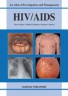 Image for HIV/AIDS: an atlas of investigation and management