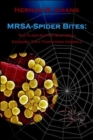 Image for MRSA - Spider Bites: The Flesh-Eating Bacterial Epidemic That Threatens America