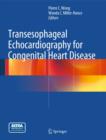 Image for Transesophageal echocardiography for congenital heart disease