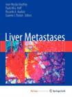 Image for Liver Metastases