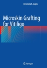 Image for Microskin Grafting for Vitiligo