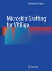 Image for Microskin grafting for vitiligo
