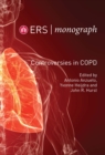 Image for Controversies in COPD