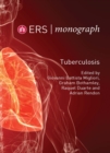 Image for Tuberculosis