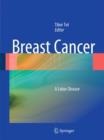 Image for Breast cancer  : a lobar disease